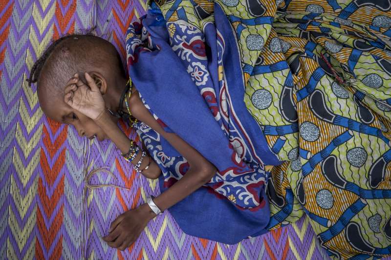 طفل لاجئ من جمهورية إفريقيا الوسطى يعاني من سوء التغذية يرتاح في مركز التغذية في مستشفى باتوري في الكاميرون. تصوير: المفوضية السامية للأمم المتحدة لشؤون اللاجئين/ فريديرك نوي / 2014
