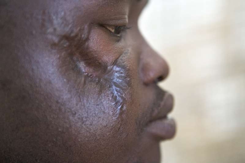 Andrew, 23, was attacked at a village market in Nigeria's Borno [&hellip;]