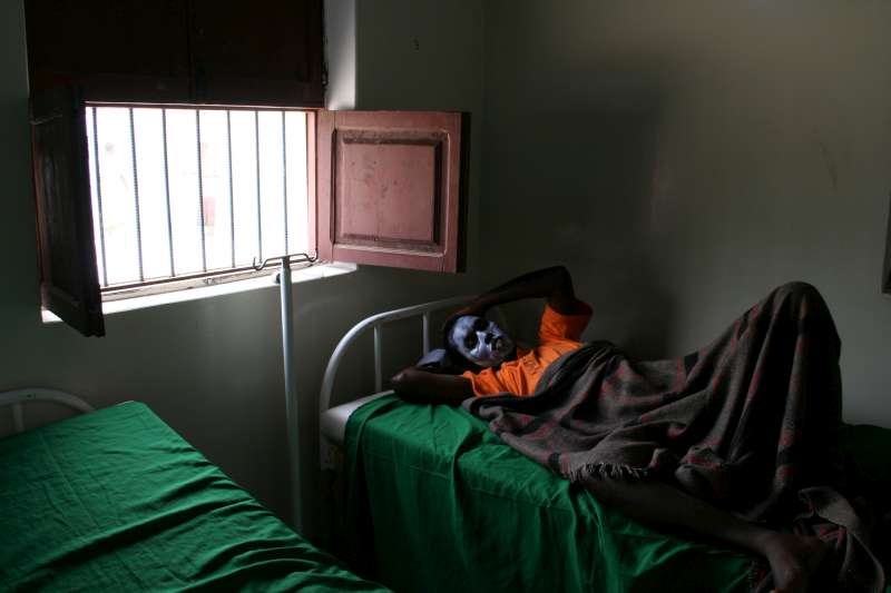 A new arrival suffering from severe sunburn at the UNHCR clinic at the Mayfa'a reception centre.