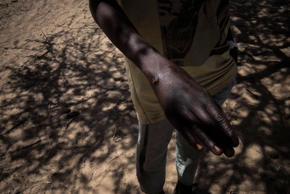 A bullet tore through Alhaji's wrist during the attack on Baga, Nigeria, on 3 January 2015. Nine other young men were executed during the attack, he says.