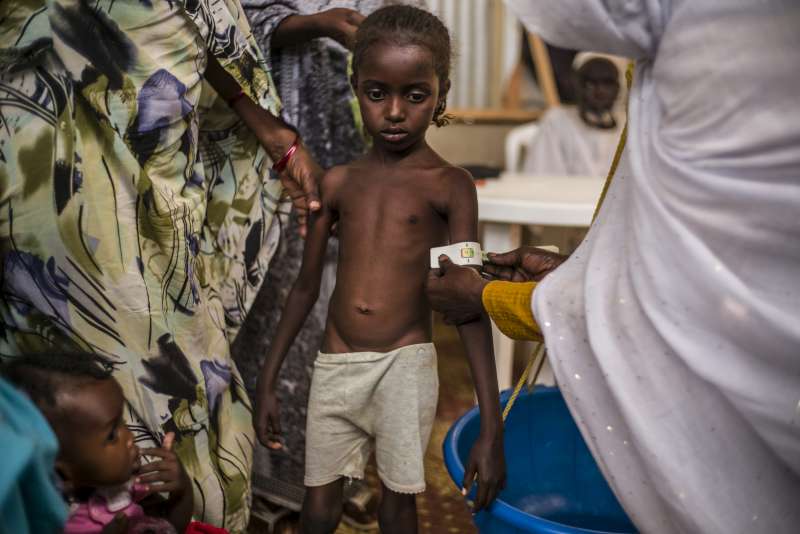 فتاة سودانية لاجئة تعاني من سوء التغذية وتخضع حالتها للمراقبة في مركز التغذية في مخيم أم نباك للاجئين. 