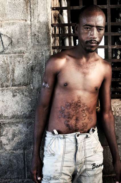 أكافيت، البالغ من العمر 29 عاماً، فر من الاضطهاد  والفقر في إثيوبيا في عام 2009. ويقول مثل العديد من أهل بلده، إنه تعرض للاحتجاز والتعذيب وأُجبر على  دفع أموال على يد مهربين بعد وصوله إلى حرض شمال اليمن.
