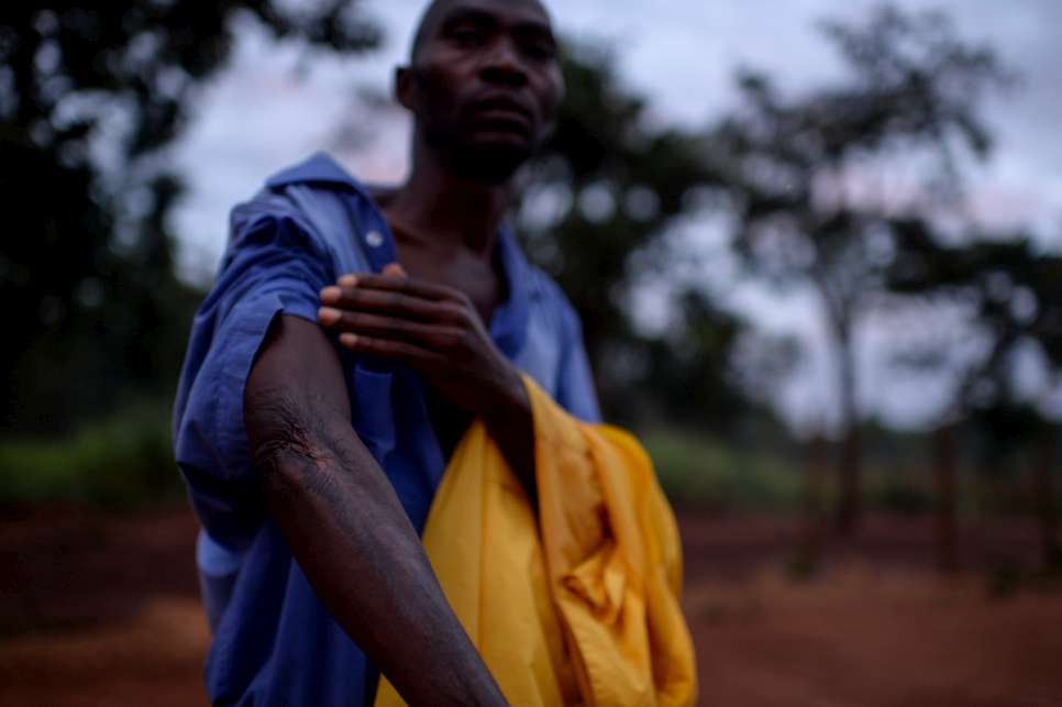 Manase Gahungu was imprisoned for three months and repeatedly tortured, with men using knives to cut pieces of his flesh from his arm like meat.