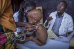 يزن الممرضون في مركز التغذية في مستشفى باتوري طفلاً يعاني من سوء التغذية الحاد قبل وقت التغذية. شكلت الرحلة الطويلة في الأحراش معاناة لهذا الطفل الرضيع.
