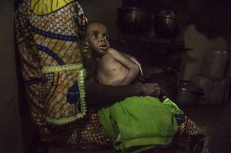 An exhausted mother and her baby wait for the milk distribution at the Batouri Hospital nutrition centre. The centre currently treats about 100 refugee children for severe malnutrition, but more are on the way and the capacity is being increased. 