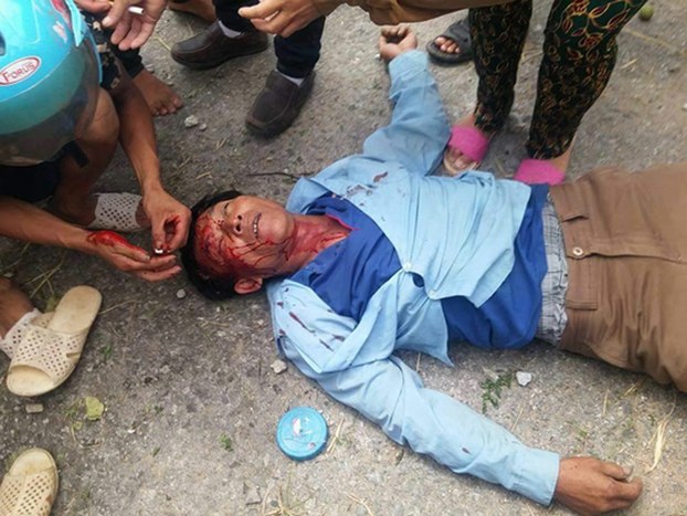 A man injured during protests over a pollution disaster in central Vietnam's Quang Binh Province receives treatment, July 7, 2016.