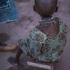 Un niño con desnutrición severa, sentado en una silla improvisada en el centro de nutrición de Batouri. 