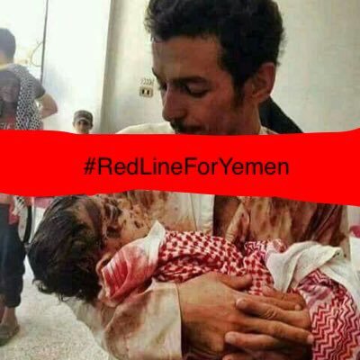 Stop War On Yemen