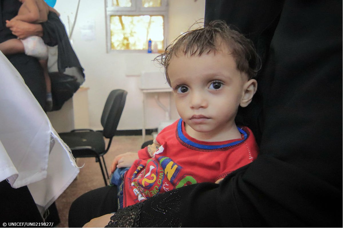 A young child wearing a red shirt stares with big eyes into the camera at a UNICEF-supported clinic in Yemen.