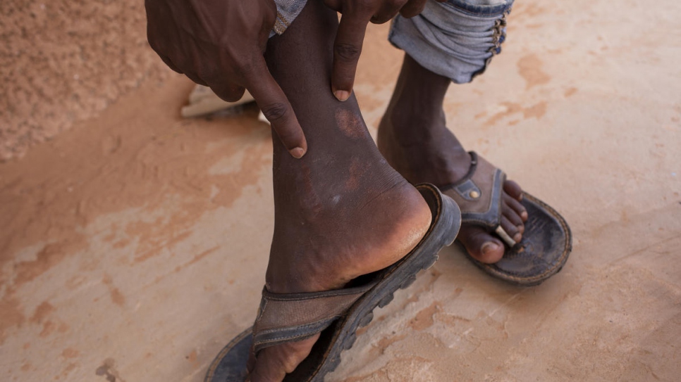 Like Maryam,* Yasir is recovering at UNHCR's Emergency Transit Mechanism camp outside of Niamey, Niger. Yasir, a Sudanese asylum-seeker, was relocated to the camp following his illegal detention in Libya, where he was shot and beaten. 