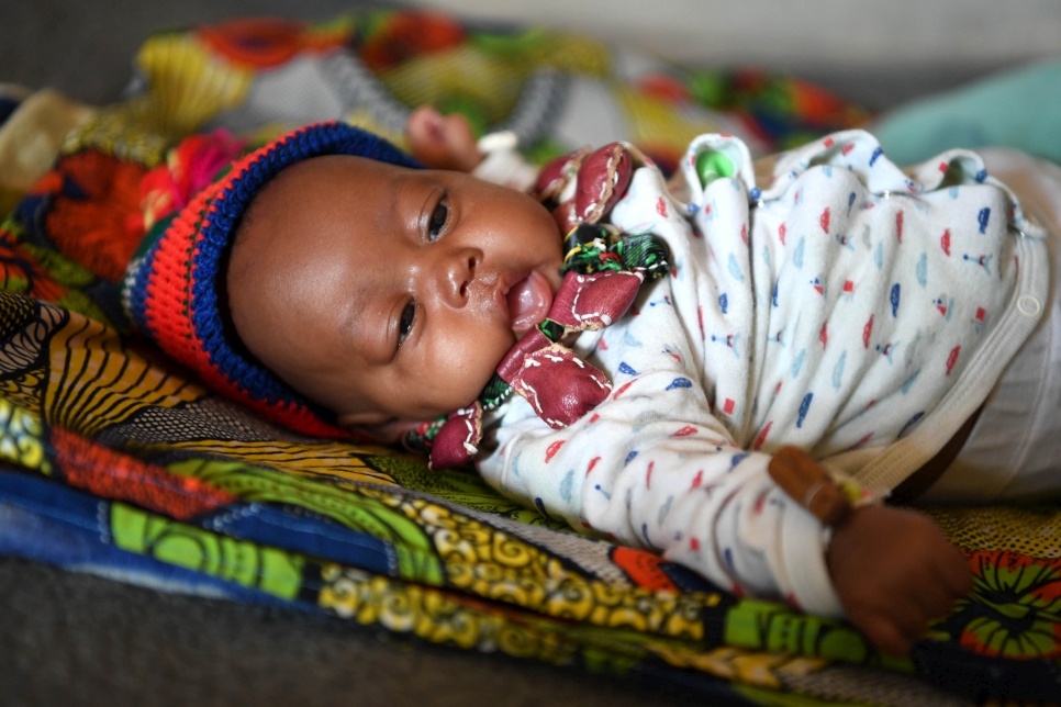 At Gado refugee site, home to 23,000 Central African refugees, a baby born weighing just 0.7 kilograms has reached a stable weight of 3 kilograms thanks to the Kangaroo method used by his mother, Abdouraman Dourou. 
