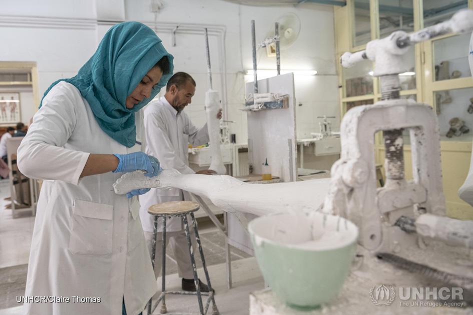 A woman is standing and making a leg cast