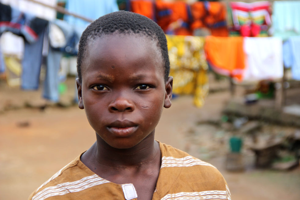 “I do not know who my parents are. I do not remember who they are”. Issa was abandoned when he was very young. He has no identity papers that show where he is from or who his parents are. UNHCR/Arnaud Froger