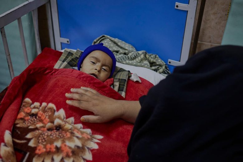 Eight-month-old Barkatullah, who is suffering from malnutrition, is comforted by his mother