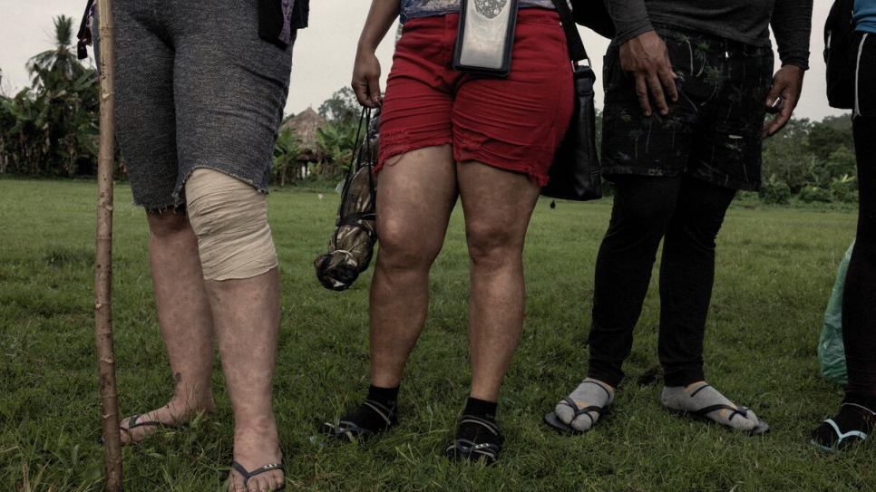 Des femmes montrent leurs jambes piquées par les moustiques après avoir traversé la jungle du Darien.  