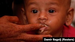 A malnourished child is fed at a UNICEF medical center in Bangladesh. (file photo)