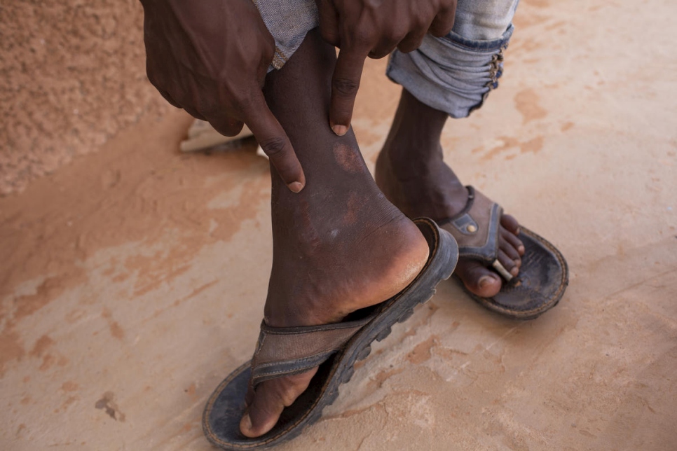 Tal como Maryam*, Yasir se está recuperando en el campamento del Mecanismo de Tránsito de Emergencia en las afueras de Niamey, en Níger. Yasir, un solicitante de asilo sursudanés, fue reubicado en el campamento después de una detención ilegal en Libia, donde le dispararon y lo golpearon.