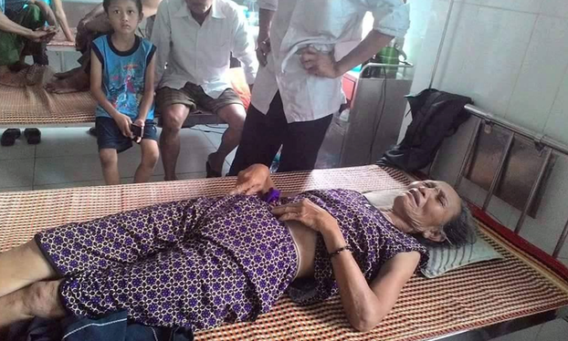 Vietnamese woman injured by police beating is shown in Ky Anh township hospital, Aug. 15, 2016.