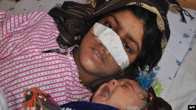 Afghan woman Reza Gul, 20, and whose nose was sliced off by her husband in an attack, lies on a bed with her baby as she receives treatment at a hospital in the northern Afghanistan on January 19.