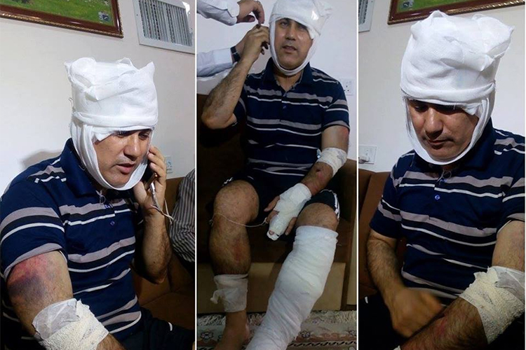 Ibrahim Abbas recovers after five men beat him in Erbil on July 10, 2017. (Aso Abbas)