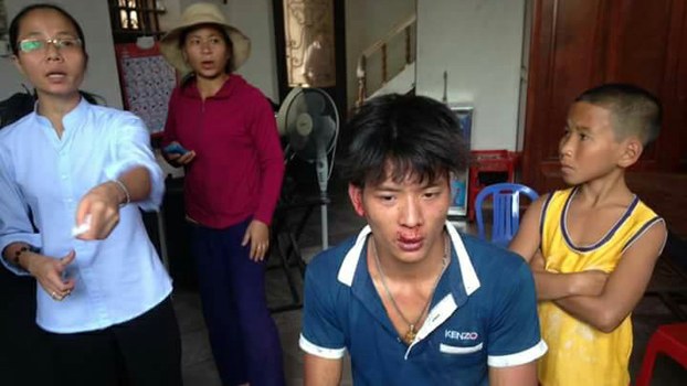 A parishioner who was beaten by thugs at the Son Hai commune People's Committee, May 28, 2017.